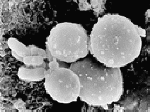candida